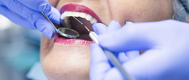 Best Emergency Broken Tooth Repair in Good Hope, AL